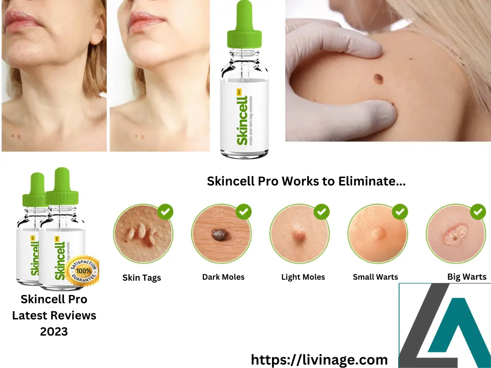 Skincell Pro Mole and skin tag corrector serum
